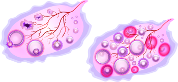 Menopauze