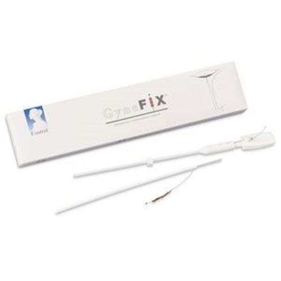 Afbeelding van Gynefix copper iud 1 