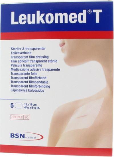 Leukomed T 11.0 x 14 cm steriel