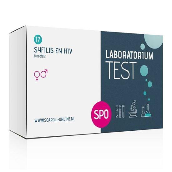 SOApoli Syfilis- en HIV-zelftest