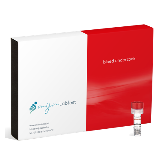 Mijnlabtest Vitamine D tekort bloedtest